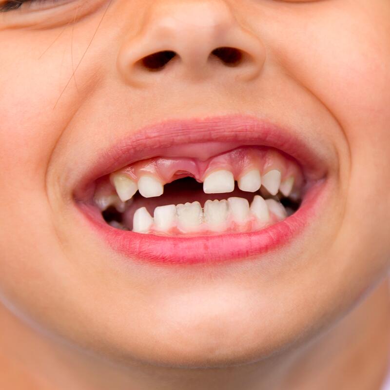 Rüyada Diş Dökülmesi Görmek